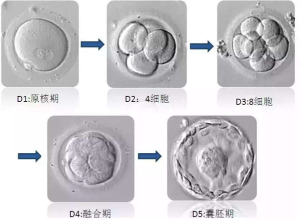 在石家庄只有试管婴儿可以让卵泡生长但不爆裂